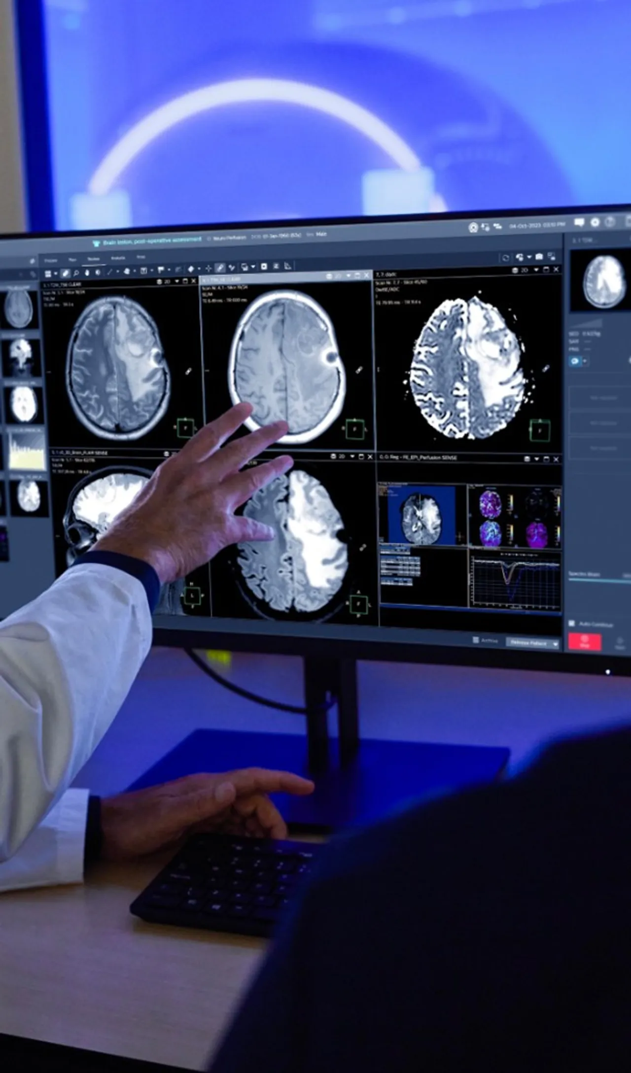 DocNote launches its Radiology mode